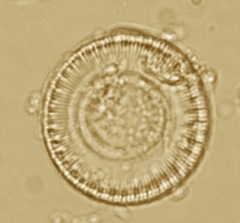 Cyclotella