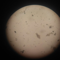 Macrotrachela quadricornifera