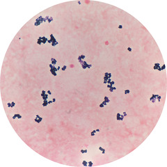 Micrococcus luteus