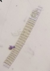 Fragilaria