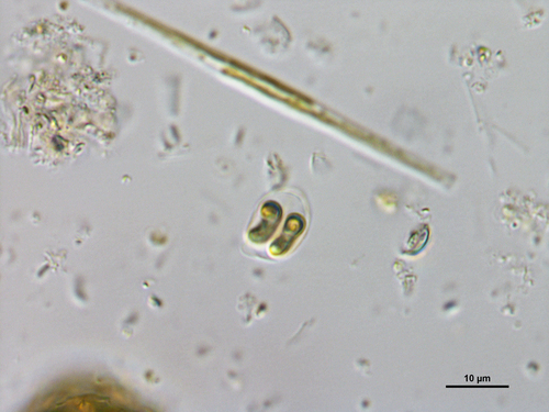 Nephrochlamys