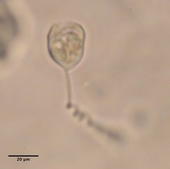 Vorticella