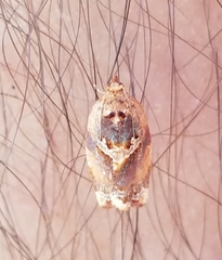 Argyrotaenia amatana