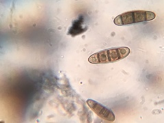 Hysterium angustatum