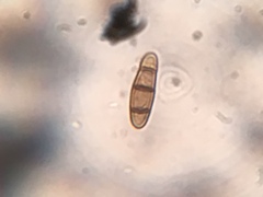 Hysterium angustatum