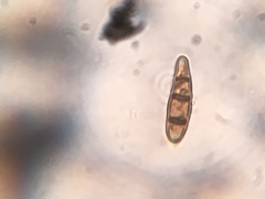 Hysterium angustatum