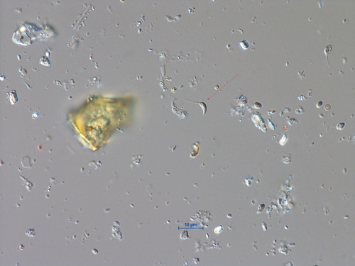 Spermatozopsis