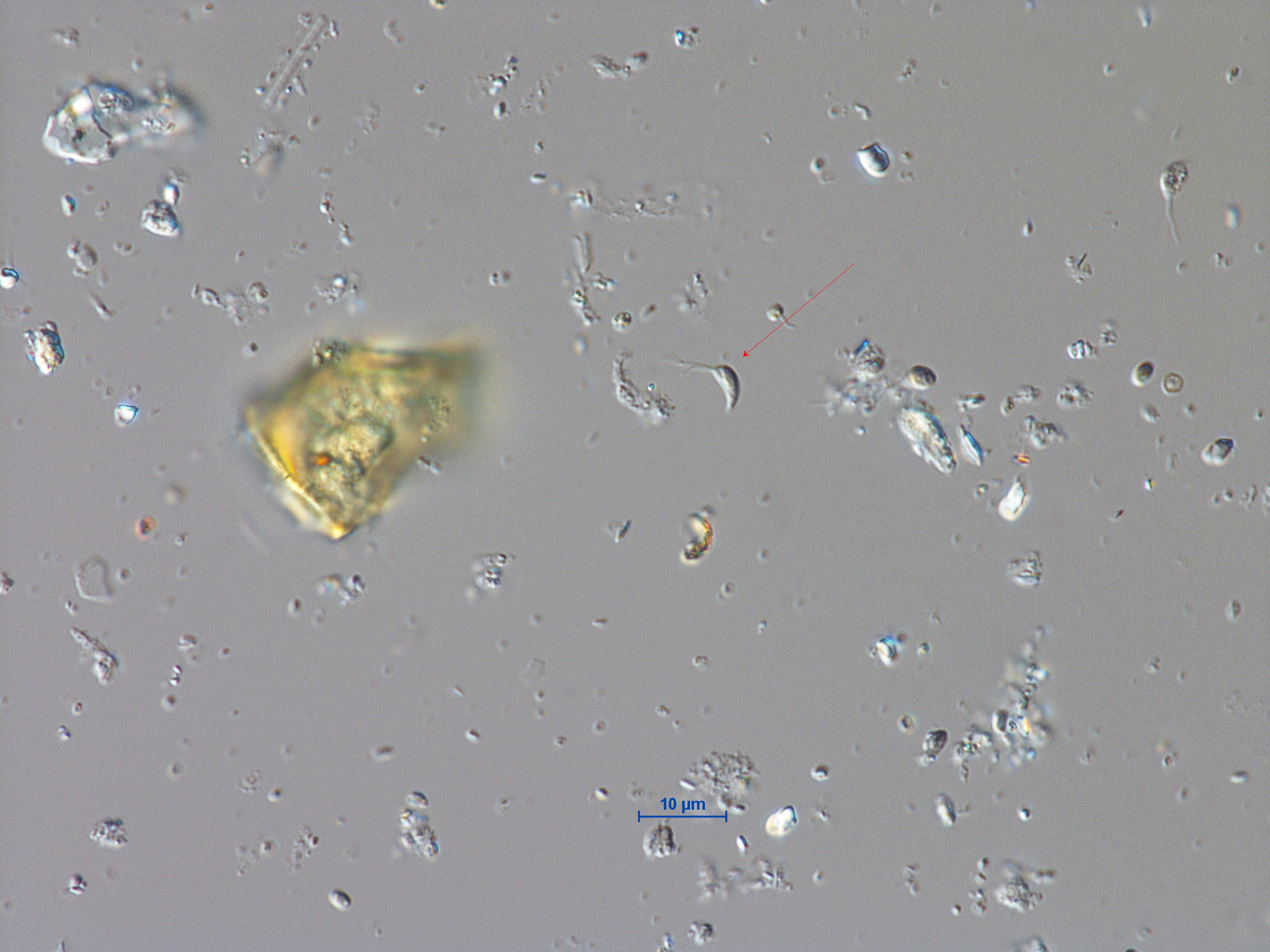 Spermatozopsis