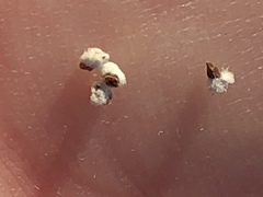 Phylica callosa