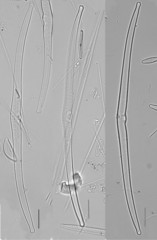 Hannaea superiorensis