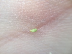 Plagiobothrys undulatus