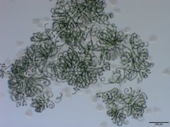 Dolichospermum lemmermannii