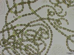 Dolichospermum lemmermannii