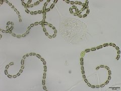 Dolichospermum lemmermannii