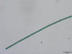 Planktothrix isothrix