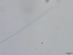 Pseudanabaena