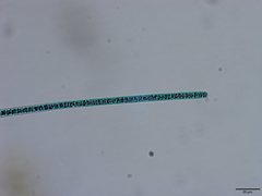 Planktothrix isothrix