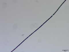 Dolichospermum