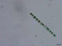 Dolichospermum