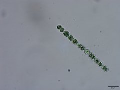 Dolichospermum