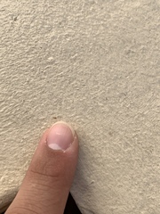 Plagiolepis alluaudi