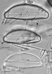 Encyonema leibleinii