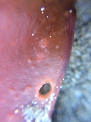 Pachymenia