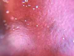 Pachymenia