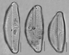 Encyonema leibleinii