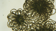 Dolichospermum lemmermannii