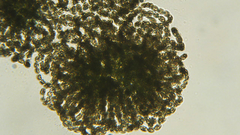 Dolichospermum lemmermannii