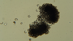 Dolichospermum lemmermannii