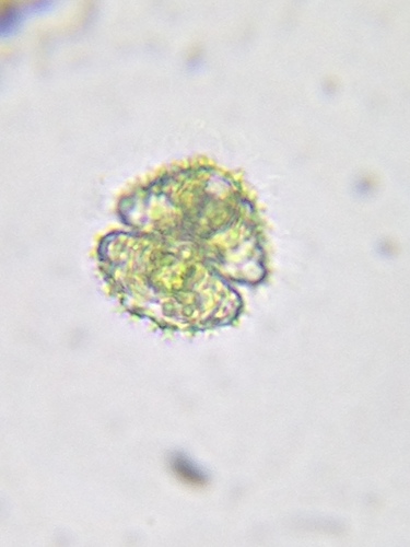 Staurastrum scabrum
