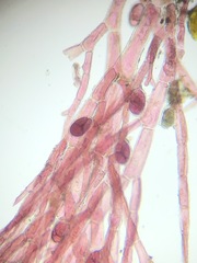 Callithamnion acutum