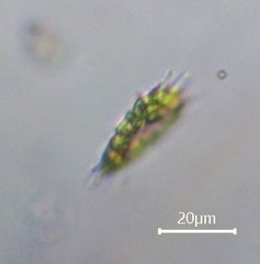 Pseudopediastrum boryanum longicorne