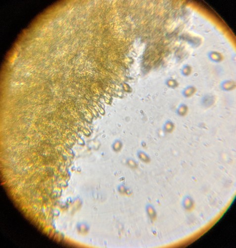 Agaricineae (Photo 8 of 13)
