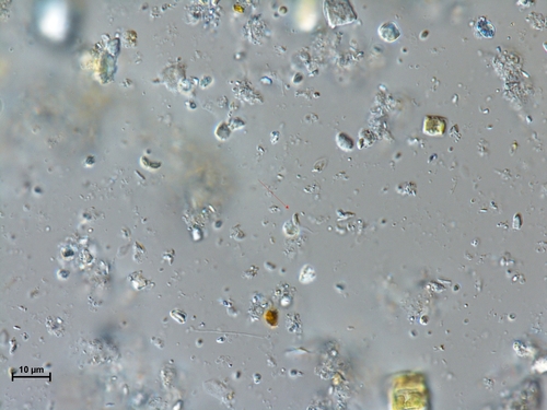 Spermatozopsis exsultans
