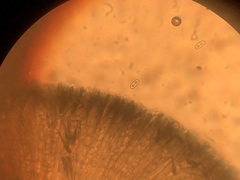 Anthracobia macrocystis