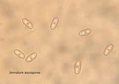 Anthracobia macrocystis