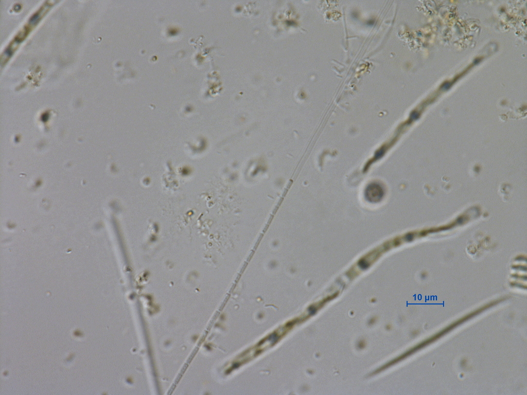 Planktolyngbya limnetica