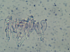 Phlebiella