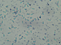 Phlebiella