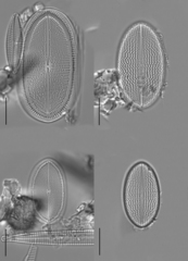 Cocconeis placentula