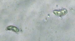 Urnula campylospora