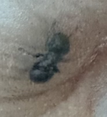 Turtle Ants