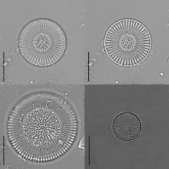 Cyclostephanos dubius