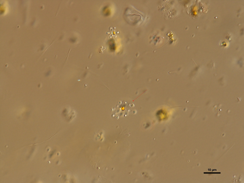Cyanogranis