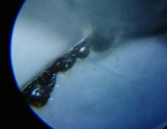 Melanotus