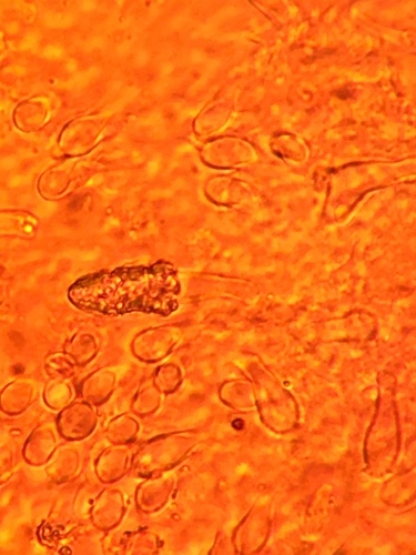Resupinatus (Photo 4 of 9)