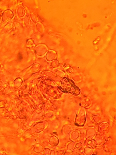 Resupinatus (Photo 5 of 9)
